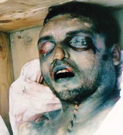 Photos of Albanians killed, tortured and expelled by Serbian military and police in 1989-1999.
