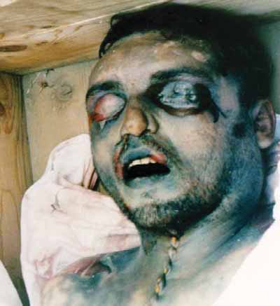Photos of Albanians killed, tortured and expelled by Serbian military and police in&nbsp;1989-1999.