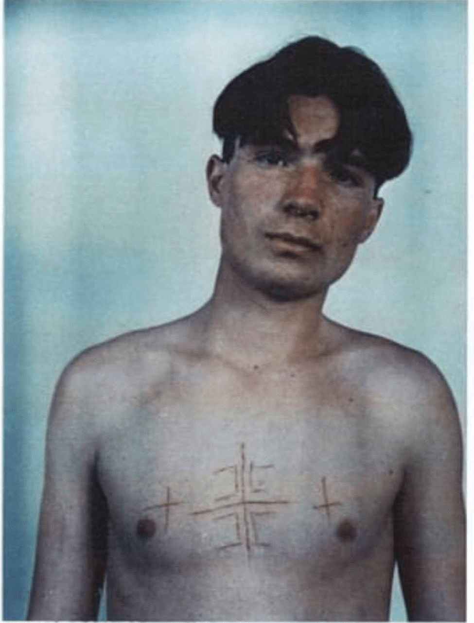 Serbian torture of 18-year old Arian Curri: carved a cross on his&nbsp;chest