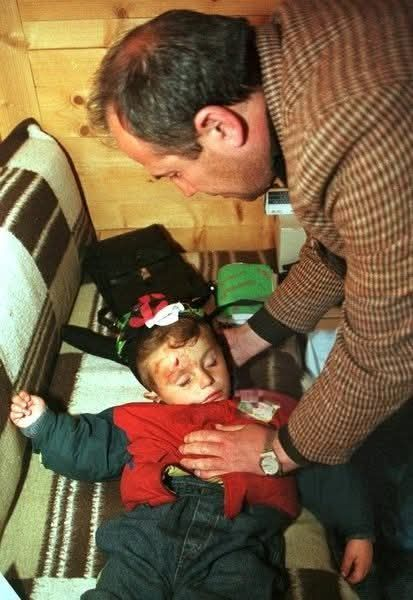 When Serbs shelled the family home of a two-year old boy named Arbër Hajdari in March 1999
