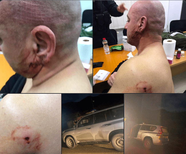The lies of Aleksandar Vučić about the Serbian terrorist attack and the injuries of Police officer Ekrem Neziri