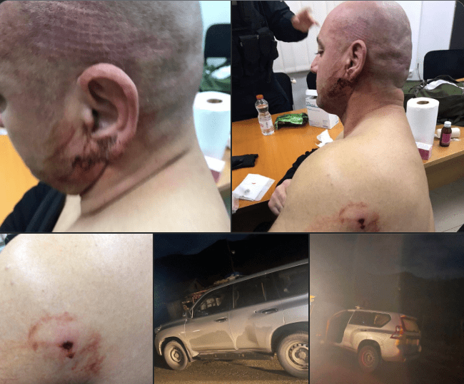 The lies of Aleksandar Vučić about the Serbian terrorist attack and the injuries of Police officer Ekrem Neziri