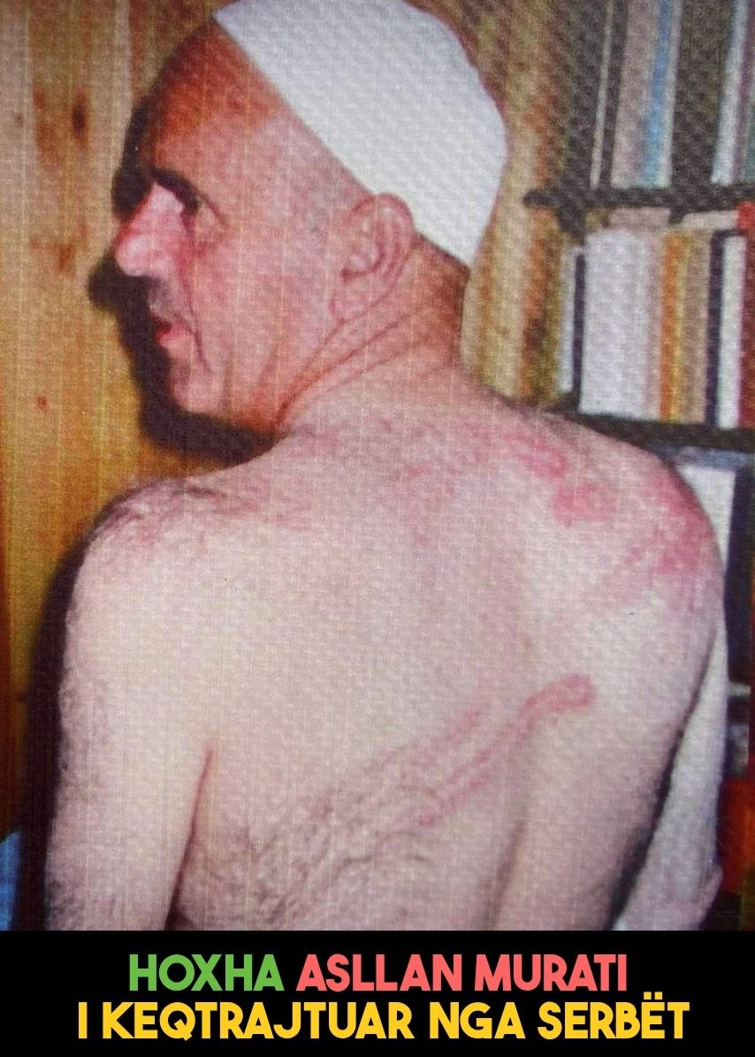 When the Serbian police arrested an Albanian imam (hoxhë) from Mitrovica and tortured him in&nbsp;1993