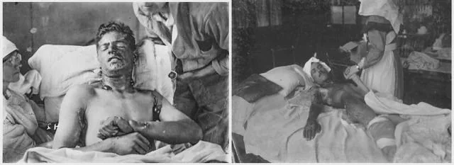 War Crimes: The Serbian Use of Poison Gas Against Albanians in Kosovo, 1918