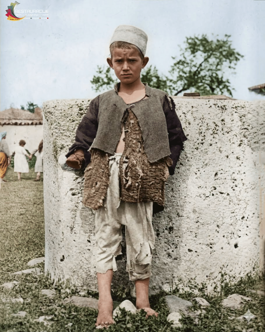 Louis Hines photograph from 1920: A 12-year old Albanian boy from Kosovo who lost his arm during the Balkan Wars